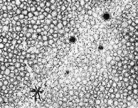 Ethereal Worlds and Roadways for Sun-phalanxes (Close-up)